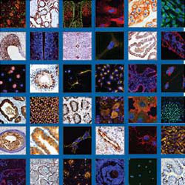 弹力纤维染色液(改良Gomori醛品红法)