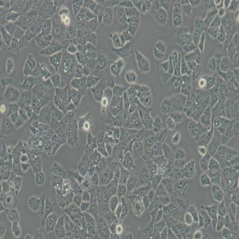 人子宫内膜癌细胞(Ishikawa)