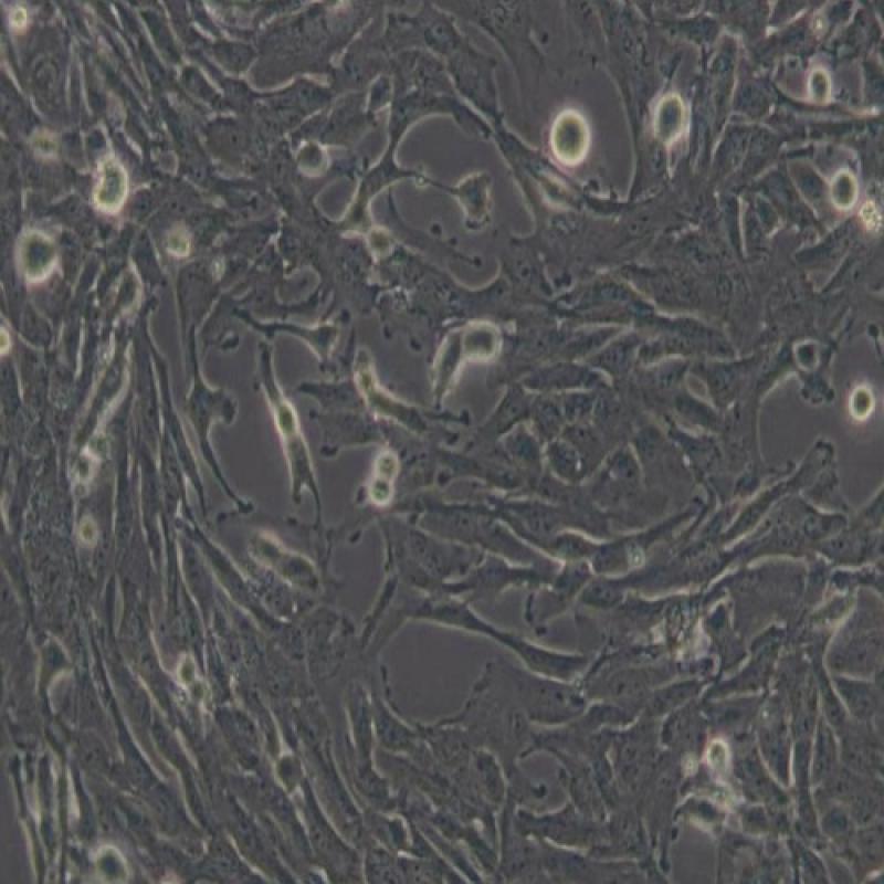 人胶质瘤细胞（U251）