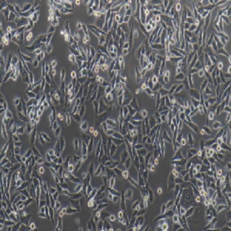 人肝癌细胞(Hep3B2.1-7)