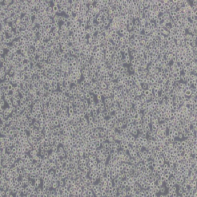 人慢性髓原白血病细胞(K562)