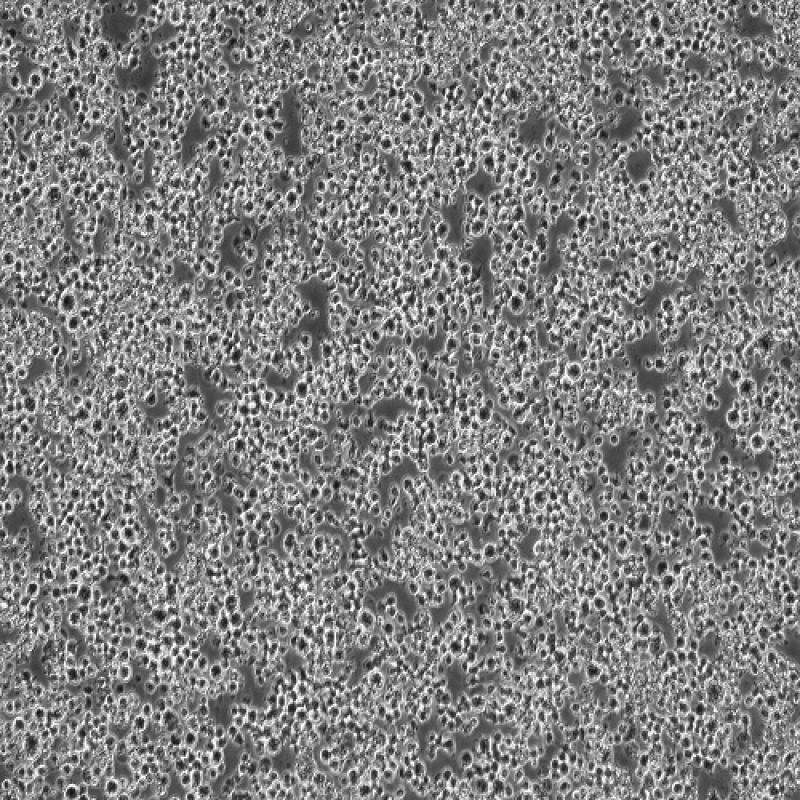 小鼠巨噬细胞（Ana-1）