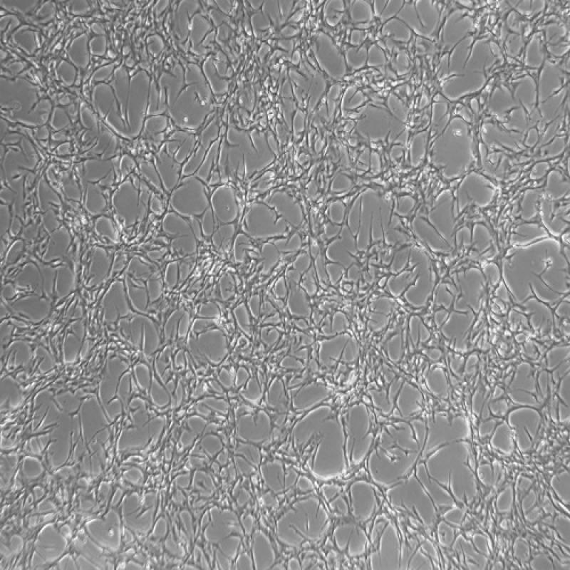 人脑星形胶质母细胞瘤U87MG