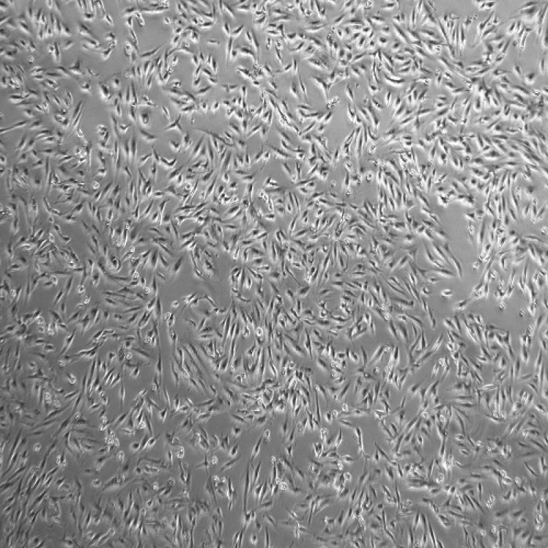 人肾透明细胞癌皮肤转移细胞Caki-1