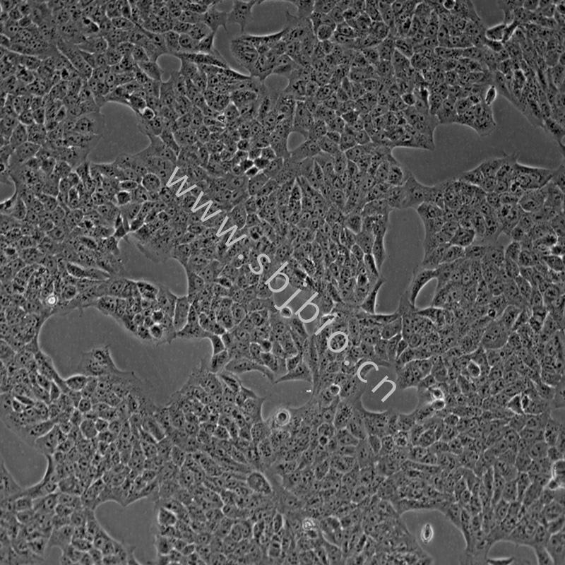 人类永生化表皮细胞(HacaT)