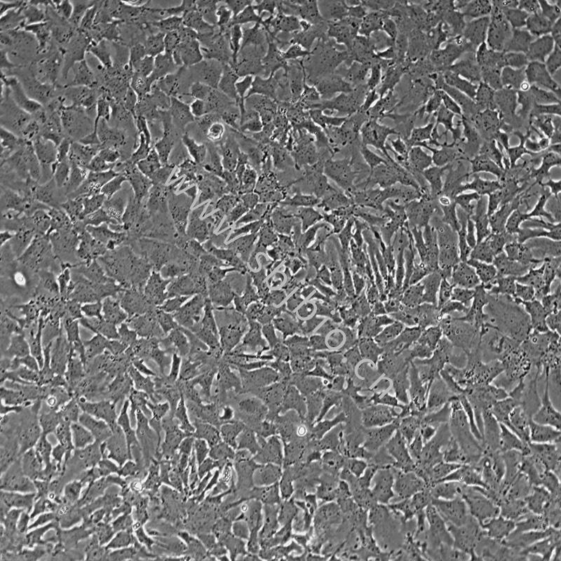人肝癌细胞(Hep3B2.1-7)