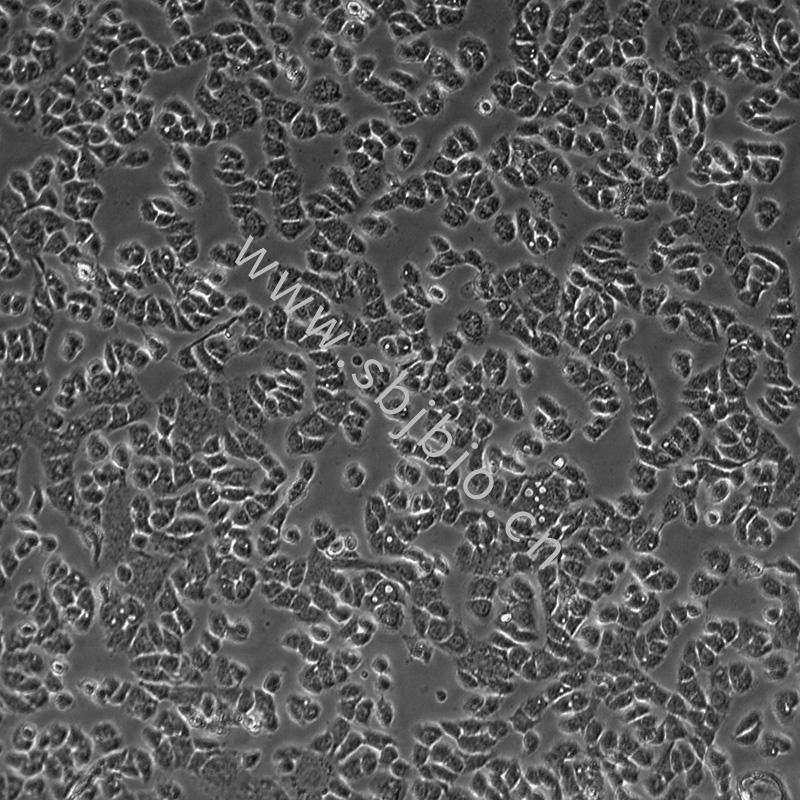人口腔鳞状细胞癌细胞HSC-3