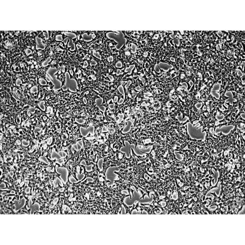 大鼠胰岛细胞瘤细胞 （INS-1）